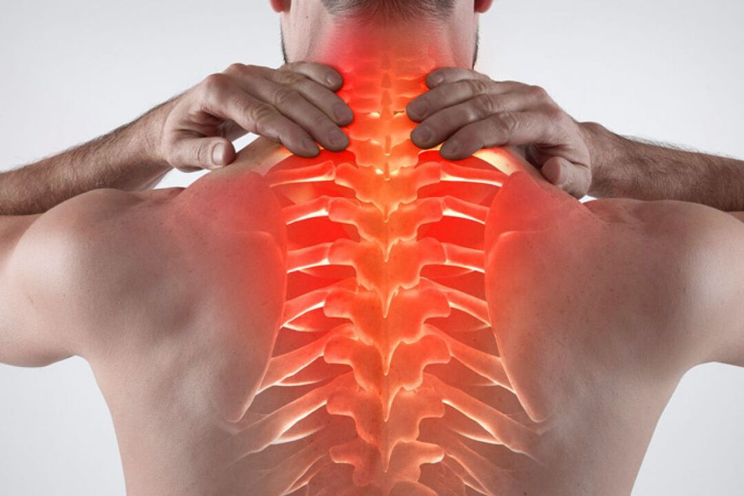 thoracic osteochondrosis