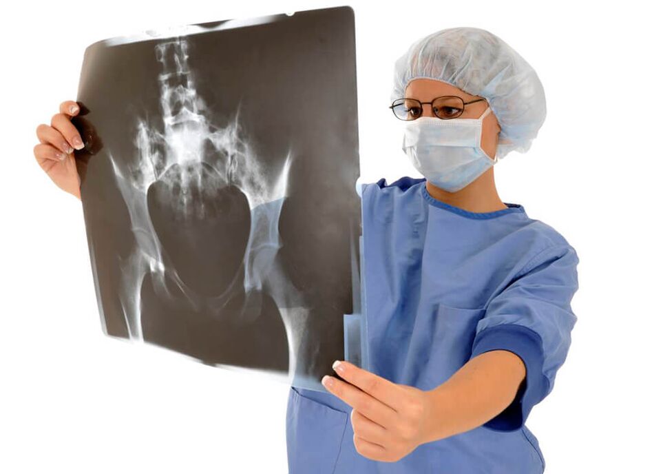 X-rays of the hip joint will help the doctor determine the cause of the pain