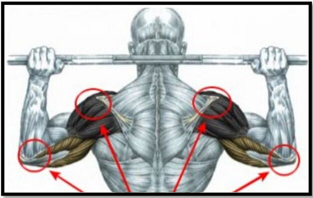 The strain on the muscles of the shoulder and elbow is one of the causes of arthrosis of the shoulder joint