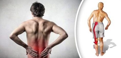 Lumbar osteochondrosis pain syndrome is emitted to the feet